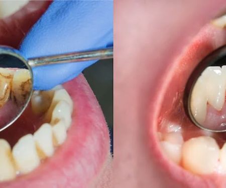 Stites Dental Care