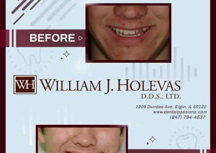 William J. Holevas D.D.S., LTD.