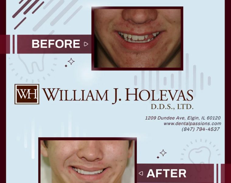 William J. Holevas D.D.S., LTD.