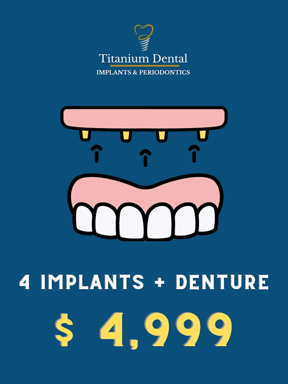 TITANIUM DENTAL Implants & Periodontics **$1,999 Implant Special** Best Price in GA! 9