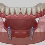 Naples Dental Boutique