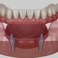 Naples Dental Boutique ico
