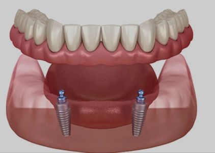 Naples Dental Boutique