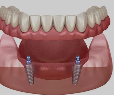 Naples Dental Boutique