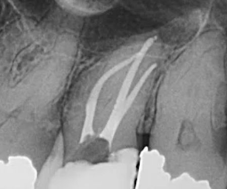 North Penn Endodontics Group