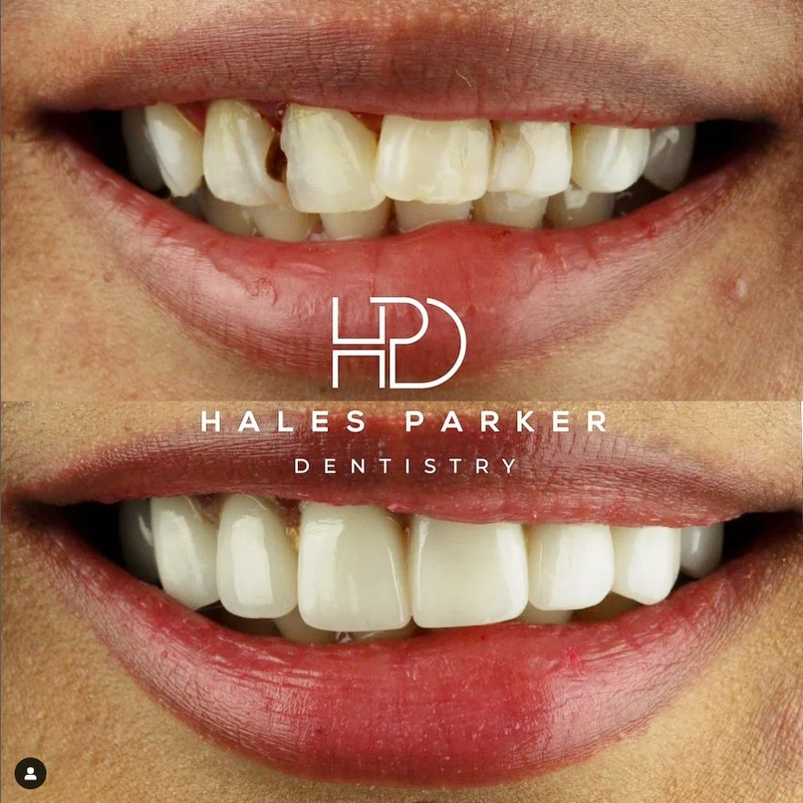 Facer Hales Parker Dentistry 2