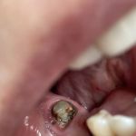 Blash Dentistry