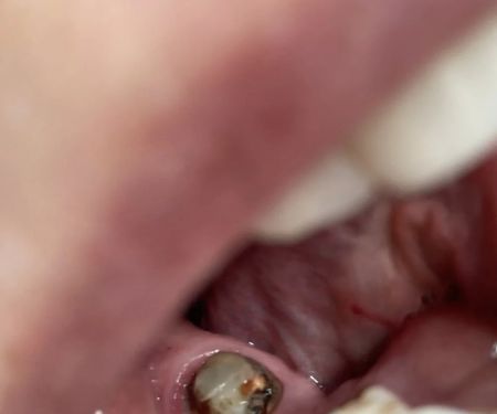 Blash Dentistry