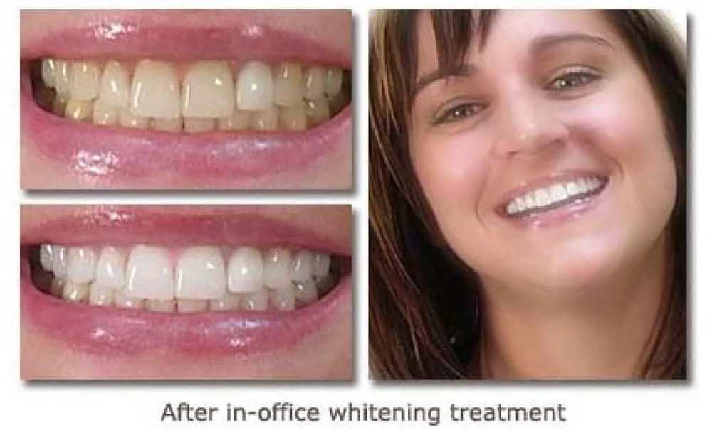ACE DENTAL 2