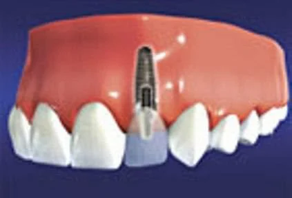ACE DENTAL 3