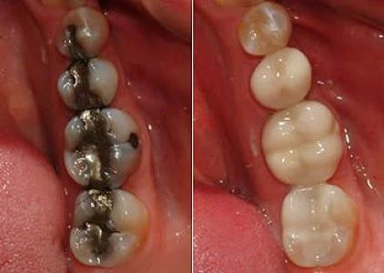 ProSmile Dentistry: Parisa Zarbafian DDS