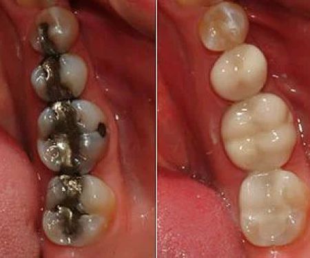 ProSmile Dentistry: Parisa Zarbafian DDS