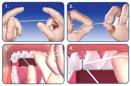 ProSmile Dentistry: Parisa Zarbafian DDS 4