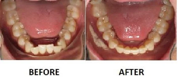 ProSmile Dentistry: Parisa Zarbafian DDS 5