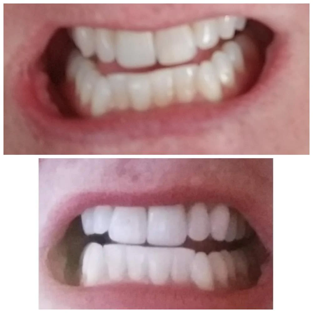 Malibu Teeth Whitening, Inc 2