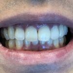 Foothill Smiles