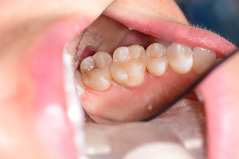 Foothill Smiles Picture 9
