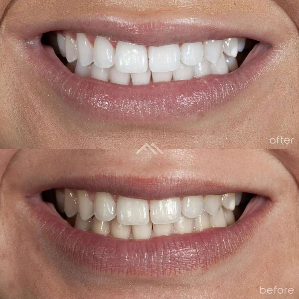 Foothill Modern Dental - Selina Sarno, DDS 5