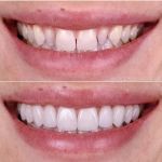 Lourdes's Dentistry - Affordable Dentist
