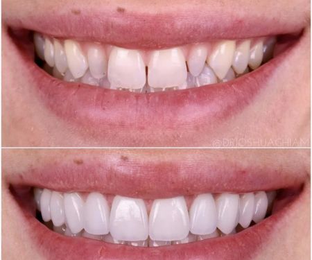 Lourdes's Dentistry - Affordable Dentist