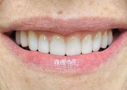 Richard O'Braitis DDS