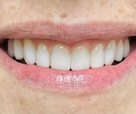Richard O'Braitis DDS