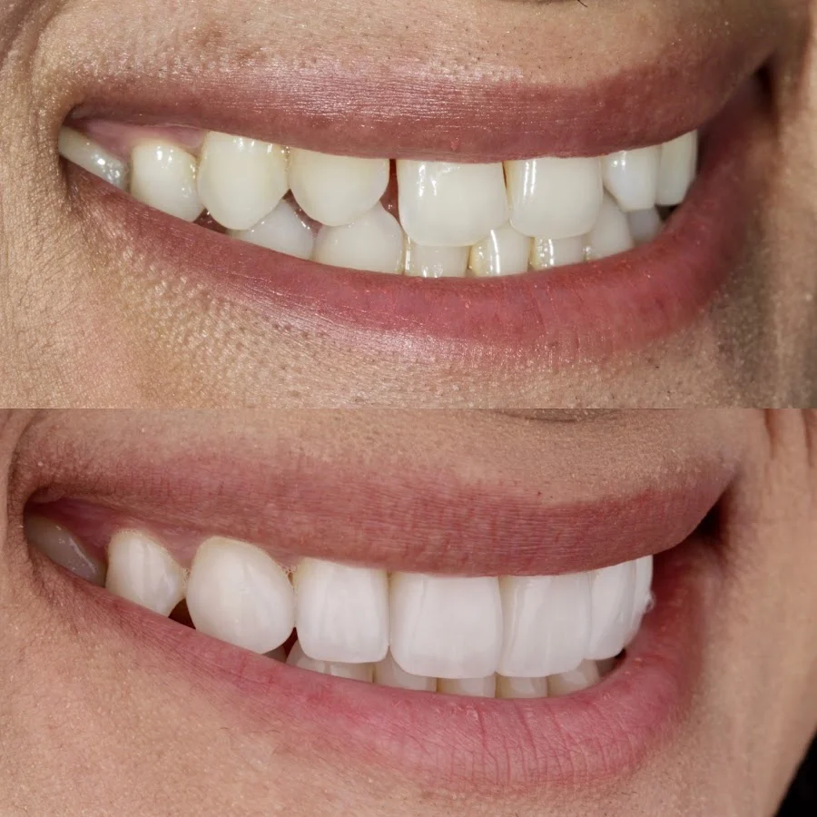 Nova Cosmetic Dentistry (general and cosmetic) 5