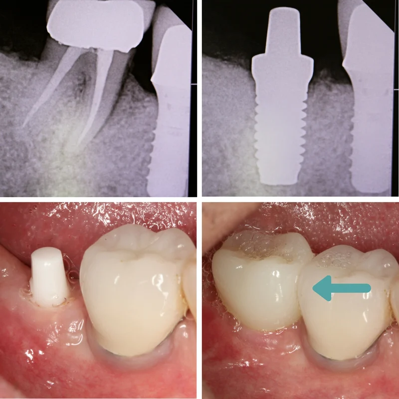 Mission Implant Center 6