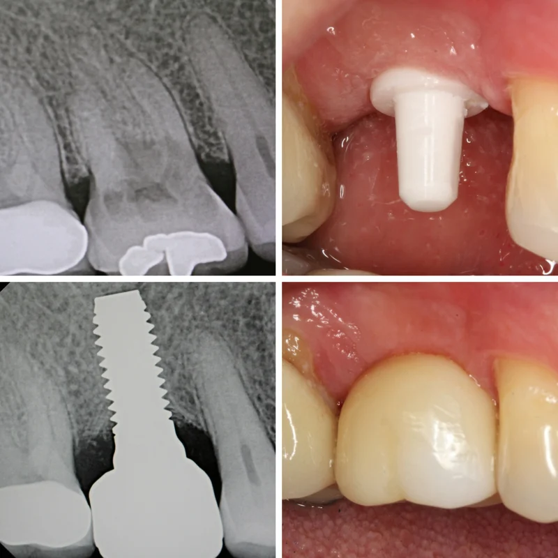 Mission Implant Center 3