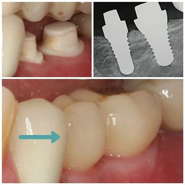 Mission Implant Center 8