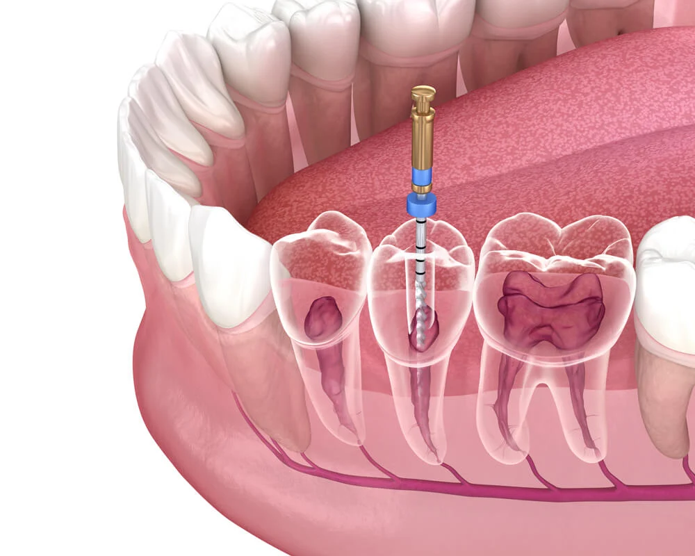 Oso Marguerite Dental Mission Viejo - Dentist - Cosmetic Dentist In Mission Viejo 3