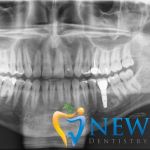 New Age Dentistry of Naples