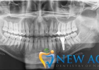 New Age Dentistry of Naples
