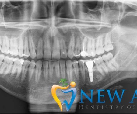 New Age Dentistry of Naples