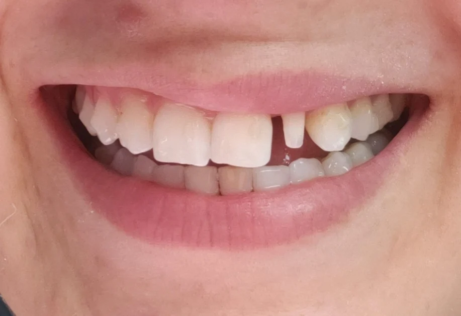 Corona Dental Group Picture 2