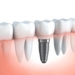 Norco Hills Advanced Dentistry