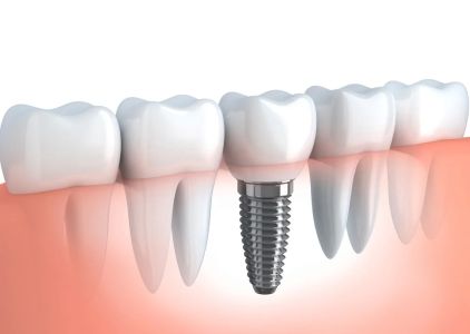 Norco Hills Advanced Dentistry
