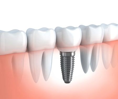 Norco Hills Advanced Dentistry