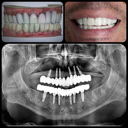 Dental World 4
