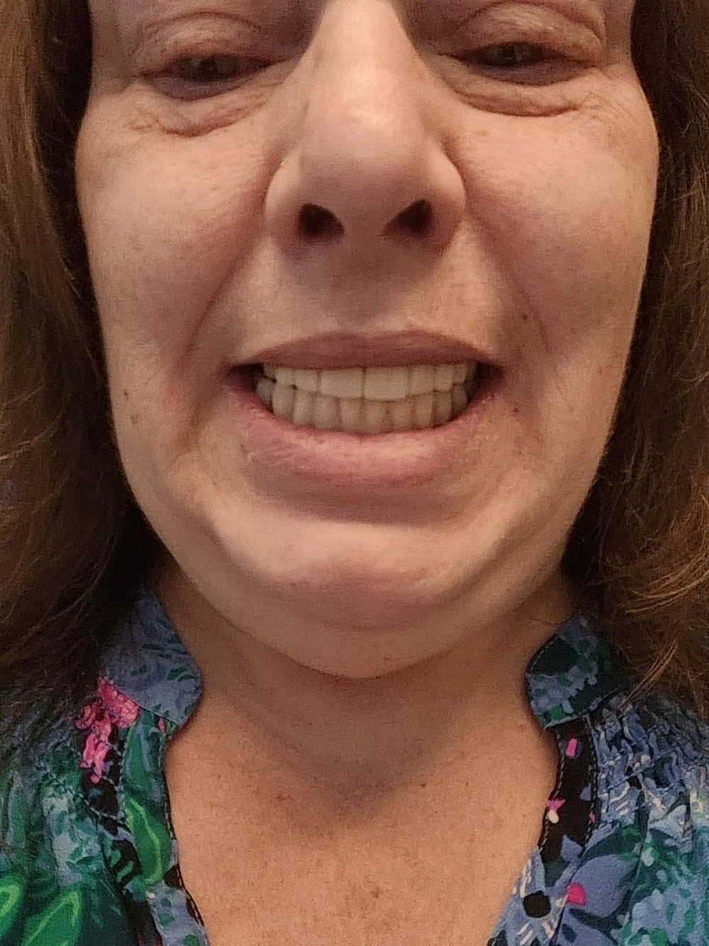 Olde Naples Periodontics - Denise C. Gay, D.D.S, M.D.S 6