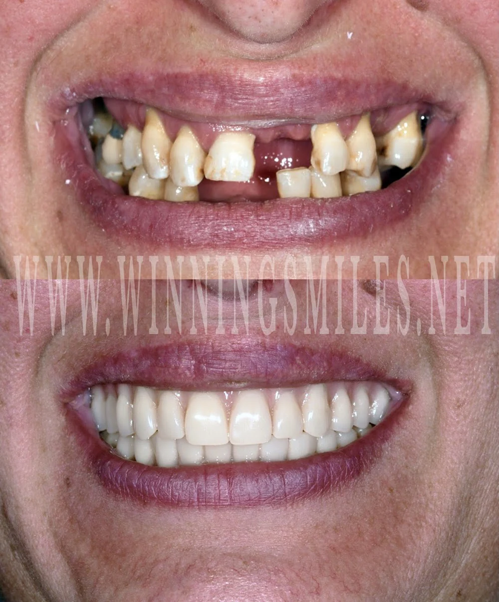 WinningSmiles Custom Dentistry & Implant Center 2