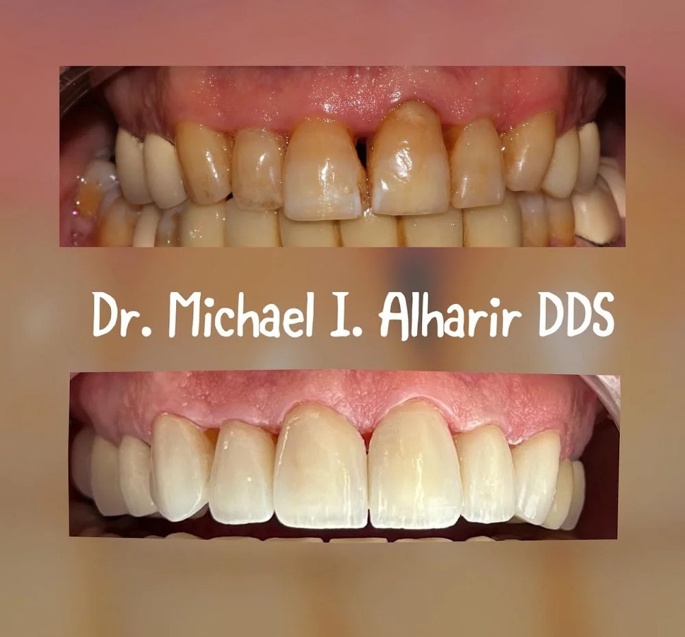 Silkmann DDS 10