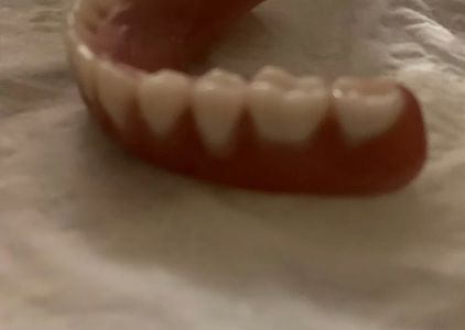 Affordable Dentures & Implants