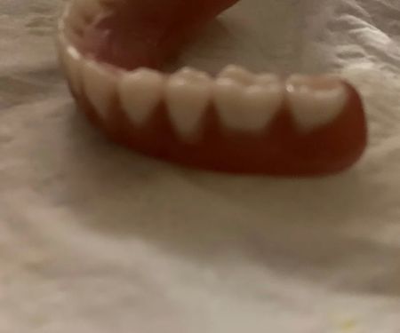 Affordable Dentures & Implants