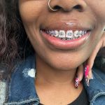 Essence Orthodontics