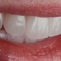 James Fondriest, DDS, FACD, FICD ico
