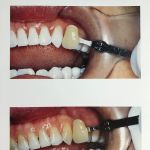 Dr. Alfonso LaPelusa, DDS