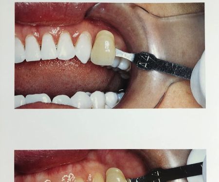 Dr. Alfonso LaPelusa, DDS