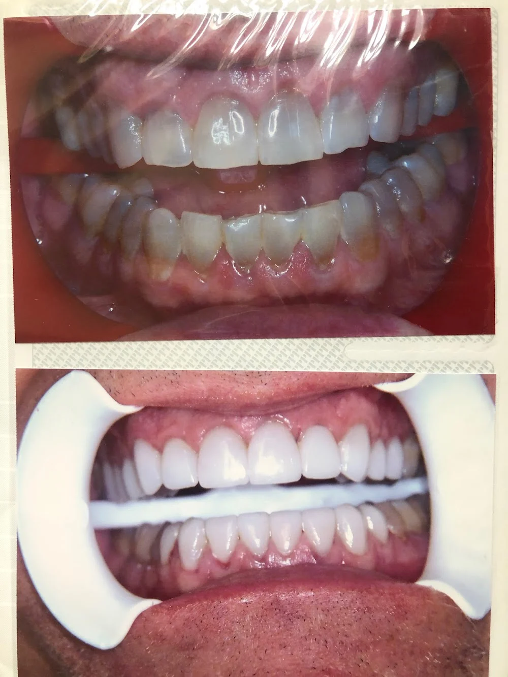 Dr. Alfonso LaPelusa, DDS 7