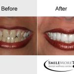Smile More Today